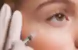 Vision Loss After Fillers: What the New Consensus Guidelines Have Changed