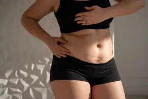 How to Tighten Skin After Weight Loss: RF, HIFU, Laser, or Surgery